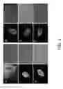 Fig. 02 - Treatment for chitin-containing microorganisms