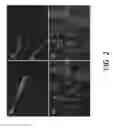 Fig. 03 - Treatment for chitin-containing microorganisms