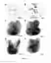 Fig. 05 - CONVERSION OF CARDIOMYOCYTES INTO FAST CONDUCTING CARDIOMYOCYTES OR SLOW CONDUCTING NODAL CELLS