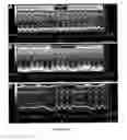 Fig. 19 - CONVERSION OF CARDIOMYOCYTES INTO FAST CONDUCTING CARDIOMYOCYTES OR SLOW CONDUCTING NODAL CELLS