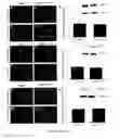 Fig. 23 - CONVERSION OF CARDIOMYOCYTES INTO FAST CONDUCTING CARDIOMYOCYTES OR SLOW CONDUCTING NODAL CELLS