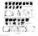 Fig. 25 - CONVERSION OF CARDIOMYOCYTES INTO FAST CONDUCTING CARDIOMYOCYTES OR SLOW CONDUCTING NODAL CELLS