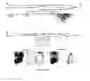Fig. 26 - CONVERSION OF CARDIOMYOCYTES INTO FAST CONDUCTING CARDIOMYOCYTES OR SLOW CONDUCTING NODAL CELLS