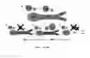 Fig. 28 - CONVERSION OF CARDIOMYOCYTES INTO FAST CONDUCTING CARDIOMYOCYTES OR SLOW CONDUCTING NODAL CELLS