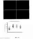 Fig. 11 - Method and compositions for treating cancer using probiotics