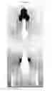 Fig. 15 - Extruded extended release abuse deterrent pill