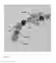 Fig. 11 - MAGNETIC NANOPARTICLES DISPERSION, ITS PREPARATION AND DIAGNOSTIC AND THERAPEUTIC USE