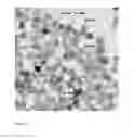 Fig. 12 - MAGNETIC NANOPARTICLES DISPERSION, ITS PREPARATION AND DIAGNOSTIC AND THERAPEUTIC USE