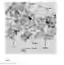 Fig. 13 - MAGNETIC NANOPARTICLES DISPERSION, ITS PREPARATION AND DIAGNOSTIC AND THERAPEUTIC USE