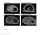 Fig. 14 - MAGNETIC NANOPARTICLES DISPERSION, ITS PREPARATION AND DIAGNOSTIC AND THERAPEUTIC USE