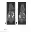 Fig. 15 - MAGNETIC NANOPARTICLES DISPERSION, ITS PREPARATION AND DIAGNOSTIC AND THERAPEUTIC USE