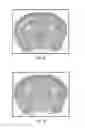 Fig. 13 - CONTRAST IMAGING APPLICATIONS FOR LANTHANIDE NANOPARTICLES