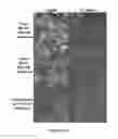 Fig. 04 - CONTROLLING EXTRACELLULAR MATRIX PROTEIN MICROSTRUCTURE WITH ULTRASOUND