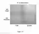 Fig. 13 - CONTROLLING EXTRACELLULAR MATRIX PROTEIN MICROSTRUCTURE WITH ULTRASOUND