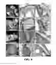 Fig. 10 - Methods of producing and using silk microfibers