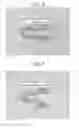 Fig. 05 - Absorbable polymeric blend compositions based on copolymers prepared from mono- and di-functional polymerization initiators, processing methods, and medical devices therefrom