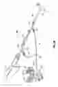 Fig. 03 - Aspiration system for thrombectomy procedures