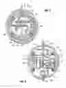 Fig. 10 - Aspiration system for thrombectomy procedures