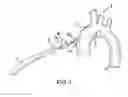 Fig. 02 - Cannula tip for an arterial cannula