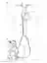 Fig. 01 - Pumping system and method for assisting a patient's heart