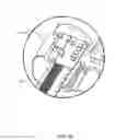 Fig. 44 - Infusion pump assembly