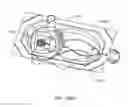 Fig. 216 - Infusion pump assembly