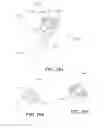 Fig. 72 - Assisted manual injector devices and methods