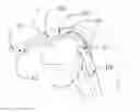 Fig. 01 - Endotracheal Tube Insertion Device