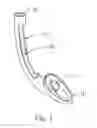 Fig. 02 - Endotracheal Tube Insertion Device