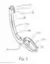 Fig. 06 - Endotracheal Tube Insertion Device