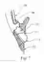 Fig. 08 - Endotracheal Tube Insertion Device