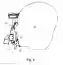 Fig. 04 - Respiratory Mask With Self-Sealing Implement Port