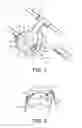 Fig. 02 - ARTICULATING HEADGEAR ATTACHMENT