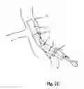 Fig. 03 - Expandable introducer sheath and related methods