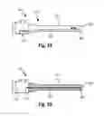 Fig. 09 - Expandable introducer sheath and related methods