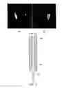 Fig. 12 - Neurosurgical apparatus and methods