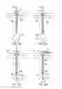 Fig. 13 - Neurosurgical apparatus and methods