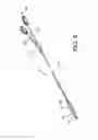 Fig. 06 - BALLOON CATHETER WITH ENHANCED LOCATABILITY