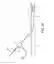 Fig. 16 - BALLOON CATHETER WITH ENHANCED LOCATABILITY