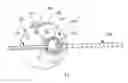 Fig. 01 - Wound Drain