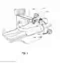 Fig. 02 - METHODS AND APPARATUS FOR TREATING DISORDERS OF THE EAR, NOSE AND THROAT