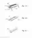 Fig. 03 - METHODS AND APPARATUS FOR TREATING DISORDERS OF THE EAR, NOSE AND THROAT