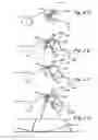 Fig. 04 - METHODS AND APPARATUS FOR TREATING DISORDERS OF THE EAR, NOSE AND THROAT