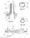 Fig. 07 - METHODS AND APPARATUS FOR TREATING DISORDERS OF THE EAR, NOSE AND THROAT