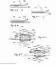 Fig. 09 - METHODS AND APPARATUS FOR TREATING DISORDERS OF THE EAR, NOSE AND THROAT