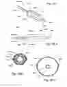 Fig. 23 - METHODS AND APPARATUS FOR TREATING DISORDERS OF THE EAR, NOSE AND THROAT