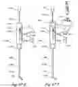 Fig. 32 - METHODS AND APPARATUS FOR TREATING DISORDERS OF THE EAR, NOSE AND THROAT
