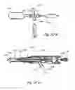 Fig. 33 - METHODS AND APPARATUS FOR TREATING DISORDERS OF THE EAR, NOSE AND THROAT