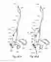 Fig. 34 - METHODS AND APPARATUS FOR TREATING DISORDERS OF THE EAR, NOSE AND THROAT