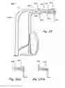 Fig. 35 - METHODS AND APPARATUS FOR TREATING DISORDERS OF THE EAR, NOSE AND THROAT